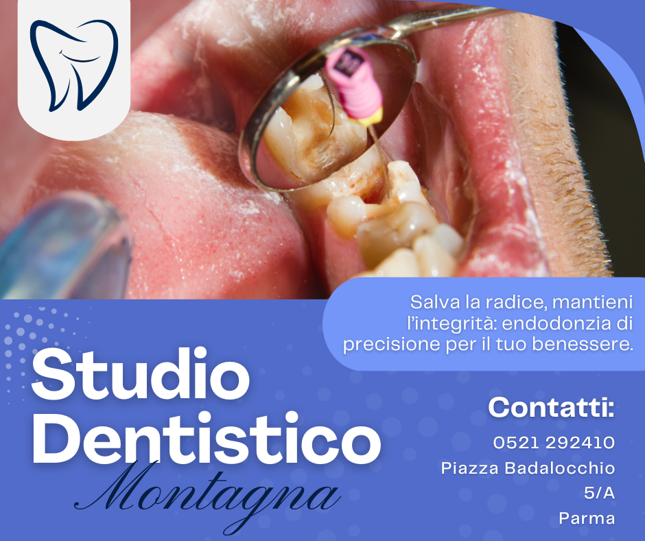 Endodonzia – Il Trattamento della Polpa Dentaria